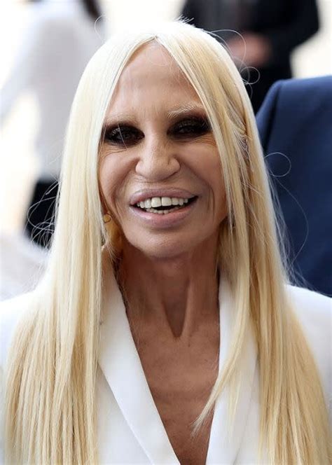 donatella versace young married|what happened to donatella versace's face.